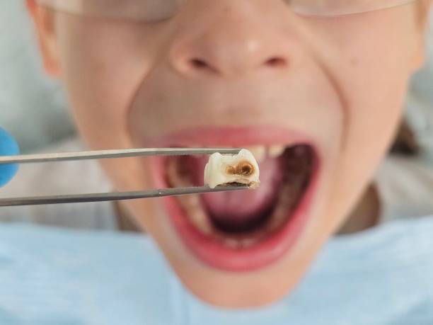 Best Chipped Tooth Repair Near Me  in Guadalupe, AZ